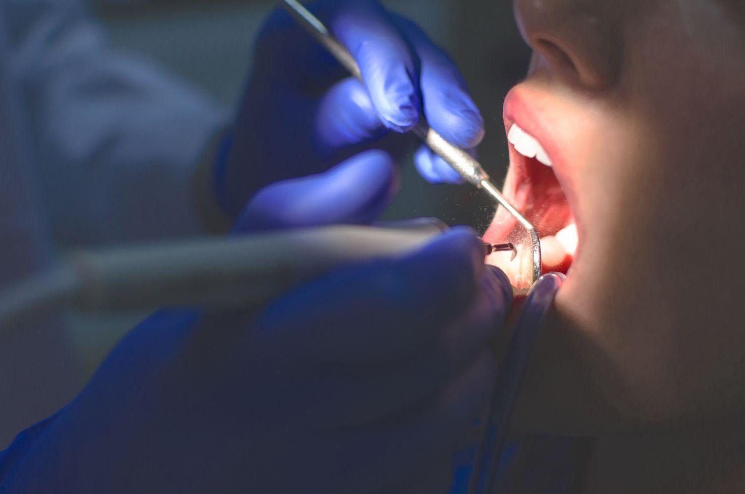 higiena i profilaktyka jamy ustnej